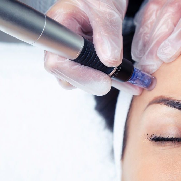 Best-Products-to-Use-After-Microneedling
